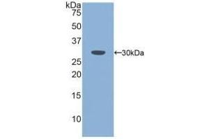 Detection of Recombinant PLS3, Mouse using Polyclonal Antibody to Plastin 3 (PLS3) (Plastin 3 Antikörper  (AA 5-251))