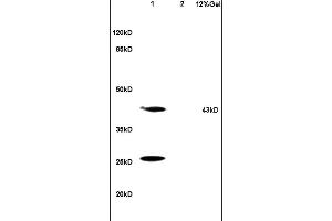 Lane 1: mouse brain lysates Lane 2: mouse kidney lysates probed with Anti HSD17B2 Polyclonal Antibody, Unconjugated (ABIN750193) at 1:200 in 4 °C. (HSD17B2 Antikörper  (AA 151-250))