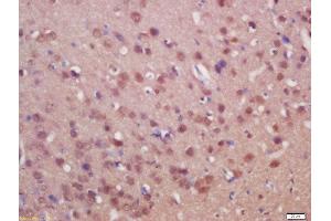 Formalin-fixed and paraffin embedded rat brain labeled with Anti-SUFU/Suppressor of Fused Polyclonal Antibody, Unconjugated  at 1:200 followed by conjugation to the secondary antibody and DAB staining (SUFUH Antikörper  (AA 433-484))