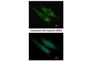 ICC/IF Image Immunofluorescence analysis of methanol-fixed HeLa, using SUCLG2, antibody at 1:200 dilution. (SUCLG2 Antikörper)
