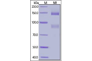 Biotinylated Human ITGAV&ITGB5 Heterodimer Protein, His,Avitag&Tag Free on  under ing (NR) condition.