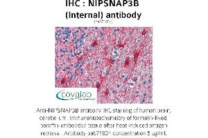 Image no. 1 for anti-Nipsnap Homolog 3B (NIPSNAP3B) (Internal Region) antibody (ABIN1737369) (NIPSNAP3B Antikörper  (Internal Region))