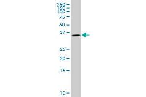 GYG1 monoclonal antibody (M08), clone 2C10. (Glycogenin 1 Antikörper  (AA 1-73))