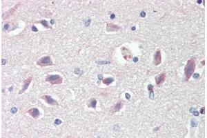 Human Brain, Cortex: Formalin-Fixed, Paraffin-Embedded (FFPE) (PRKAR1B Antikörper  (AA 106-155))