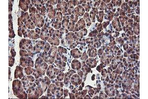 Image no. 6 for anti-V-Akt Murine Thymoma Viral Oncogene Homolog 1 (AKT1) antibody (ABIN1496558) (AKT1 Antikörper)
