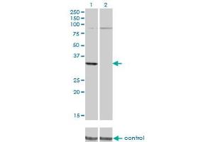 Western blot analysis of PRPS2 over-expressed 293 cell line, cotransfected with PRPS2 Validated Chimera RNAi (Lane 2) or non-transfected control (Lane 1). (PRPS2 Antikörper  (AA 160-269))