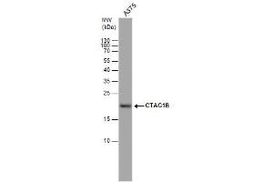 WB Image CTAG1B antibody detects CTAG1B protein by western blot analysis. (CTAG1B Antikörper)