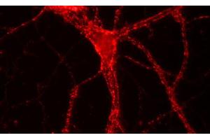 Immunofluorescence labeling of hippocampus neurons, (dilution 1 : 500). (VAMP1, 2, 3 (AA 1-81) Antikörper)