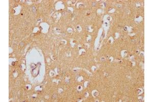 IHC image of ABIN7127430 diluted at 1:100 and staining in paraffin-embedded human brain tissue performed on a Leica BondTM system. (Rekombinanter Clusterin Antikörper)