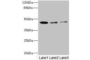 Western blot All lanes: SIGIRR antibody at 1. (SIGIRR Antikörper  (AA 1-120))