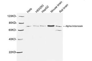 Western blot analysis of tissue and cell lysates using 1 µg/mL Rabbit Anti-Alpha Internexin Polyclonal Antibody (ABIN398867) The signal was developed with IRDyeTM 800 Conjugated Goat Anti-Rabbit IgG. (INA Antikörper  (AA 100-150))