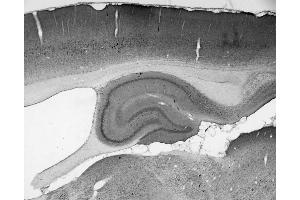 Adult rat hippocampus immunohistochemistry.