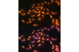 Immunofluorescence analysis of C6 cells using Snail antibody (ABIN1682836, ABIN3019402, ABIN3019403, ABIN3019404 and ABIN6220883) at dilution of 1:100.
