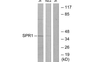 Western blot analysis of extracts from Jurkat cells and HeLa cells, using SPR1 antibody. (SPR1 Antikörper  (C-Term))