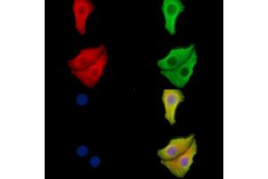 ABIN6265333 and ABIN6278532 staining Hela cells by IF/ICC. (STEAP1 Antikörper  (N-Term))