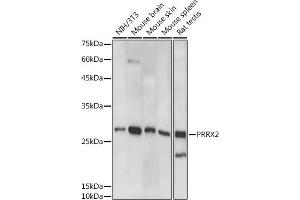 Western blot analysis of extracts of various cell lines, using PRRX2 antibody (ABIN7269158) at 1:1000 dilution. (PRRX2 Antikörper)