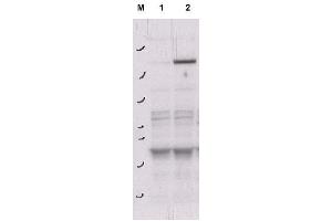 Image no. 1 for anti-rho-Associated, Coiled-Coil Containing Protein Kinase 2 (ROCK2) (pTyr256) antibody (ABIN401393) (ROCK2 Antikörper  (pTyr256))