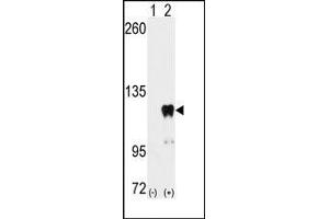 Image no. 3 for anti-Pumilio Homolog 2 (Drosophila) (PUM2) (Ser182) antibody (ABIN360017) (PUM2 Antikörper  (Ser182))