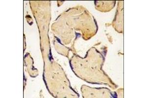 Formalin-fixed and paraffin-embedded human placenta tissue reacted with EphA3 antibody (C-term ), which was peroxidase-conjugated to the secondary antibody, followed by DAB staining. (EPH Receptor A3 Antikörper  (C-Term))