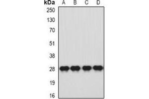 Western blot analysis of HLA-DQA1 expression in SW620 (A), HT29 (B), mouse brain (C), mouse stomach (D) whole cell lysates. (HLA-DQA1 Antikörper)