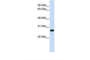 Image no. 1 for anti-Synaptosomal-Associated Protein, 23kDa (SNAP23) (AA 38-87) antibody (ABIN6738479) (SNAP23 Antikörper  (AA 38-87))