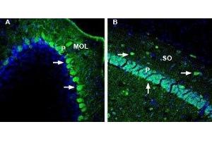Expression of DPP10 in mouse cerebellum and hippocampusImmunohistochemical staining of perfusion-fixed frozen mouse brain sections with Anti-DPP10 (extracellular) Antibody (ABIN7043099, ABIN7045044 and ABIN7045045), (1:1000), followed by goat anti-rabbit-AlexaFluor-488. (Dipeptidylpeptidase 10 (DPP10) Peptid)