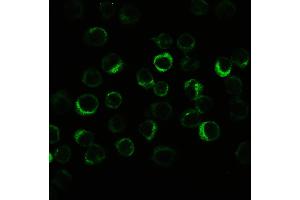 Immunohistochemistry (IHC) image for anti-NLR Family, Pyrin Domain Containing 3 (NLRP3) (AA 12-31), (N-Term) antibody (ABIN3044250)