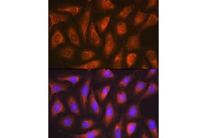 Immunofluorescence analysis of U-2 OS cells using SOCS2 Rabbit mAb (ABIN7270641) at dilution of 1:100 (40x lens). (SOCS2 Antikörper)