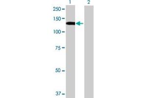 Western Blot analysis of STK31 expression in transfected 293T cell line by STK31 MaxPab polyclonal antibody. (STK31 Antikörper  (AA 1-1019))
