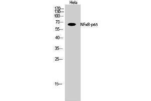 Western Blotting (WB) image for anti-Nuclear Factor-kB p65 (NFkBP65) (Thr735) antibody (ABIN6283548)