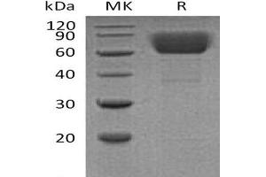 Ectonucleoside Triphosphate diphosphohydrolase 1 (ENTPD1) protein (His tag)