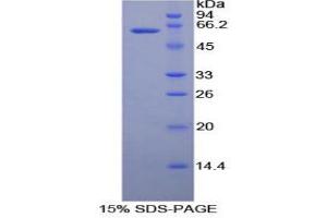 SDS-PAGE analysis of Human Ribonuclease T2 Protein.