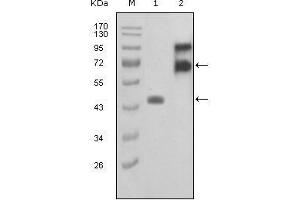 Western blot analysis using FBLN2 mouse mAb against truncated FBLN2-Trx recombinant protein (1) and truncated FBLN2 (aa28-444)-hIgGFc transfected COS7 cell lysate(2). (FBLN2 Antikörper  (AA 180-440))