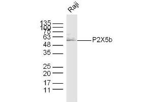 Raji (hu) lysates probed with P2X5b Polyclonal Antibody, unconjugated  at 1:300 overnight at 4°C followed by a conjugated secondary antibody at 1:10000 for 60 minutes at 37°C. (P2X5b (AA 261-360) Antikörper)