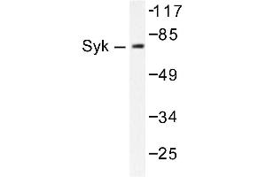 Image no. 1 for anti-Spleen tyrosine Kinase (SYK) antibody (ABIN271834) (SYK Antikörper)