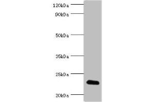 Western blot All lanes: FGF6 antibody at 10 μg/mL + HepG2 whole cell lysate Secondary Goat polyclonal to rabbit IgG at 1/10000 dilution Predicted band size: 23 kDa Observed band size: 23 kDa (FGF6 Antikörper  (AA 38-208))