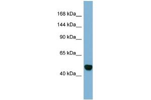 Host:  Rabbit  Target Name:  MAML3  Sample Type:  Fetal Stomach lysates  Antibody Dilution:  1. (MAML3 Antikörper  (C-Term))