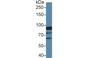 Detection of XYLT2 in Human Hela cell lysate using Polyclonal Antibody to Xylosyltransferase II (XYLT2) (XYLT2 Antikörper  (AA 596-865))