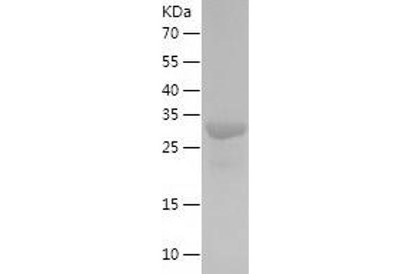 MEMO1 Protein (AA 1-297) (His tag)