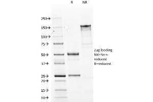 SDS-PAGE Analysis Purified Cytokeratin 14 Mouse Monoclonal Antibody (LL002). (KRT14 Antikörper  (C-Term))