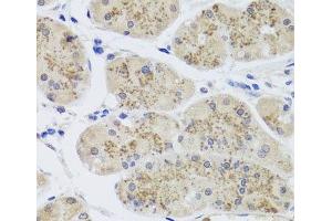 Immunohistochemistry of paraffin-embedded Human stomach using MTERFD3 Polyclonal Antibody at dilution of 1:100 (40x lens). (MTERFD3 Antikörper)