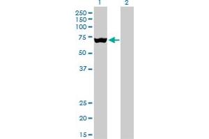 Western Blotting (WB) image for anti-Solute Carrier Family 25, Member 13 (Citrin) (slc25a13) (AA 2-80) antibody (ABIN523541)