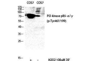 Western Blotting (WB) image for anti-Phosphoinositide 3 Kinase, p85/p55 (PI3K p85/p55) (pTyr199), (pTyr467) antibody (ABIN3182123) (PI3K p85/p55 Antikörper  (pTyr199, pTyr467))