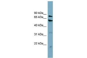 WB Suggested Anti-CPT1B  Antibody Titration: 0. (CPT1B Antikörper  (Middle Region))