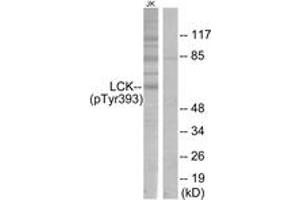 Western blot analysis of extracts from Jurkat cells, using Lck (Phospho-Tyr393) Antibody. (LCK Antikörper  (pTyr394))