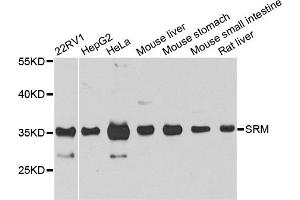 Western blot analysis of extracts of various cell lines, using SRM antibody. (Spermidine Synthase Antikörper)