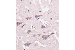 D staining Nestin in human brain tissue sections by Immunohistochemistry (IHC-P - paraformaldehyde-fixed, paraffin-embedded sections).