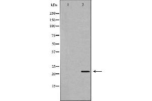 Western Blotting (WB) image for anti-Nudix (Nucleoside Diphosphate Linked Moiety X)-Type Motif 1 (NUDT1) (Internal Region) antibody (ABIN6263763)