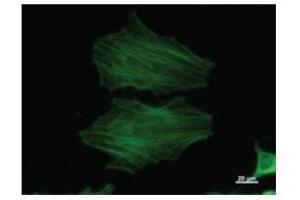 Immunostaining analysis in HeLa cells. (beta Actin Antikörper)
