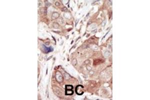Immunohistochemistry (Paraffin-embedded Sections) (IHC (p)) image for anti-VEGF Receptor 2 (VEGFR2) (AA 1326-1356), (C-Term) antibody (ABIN391979)